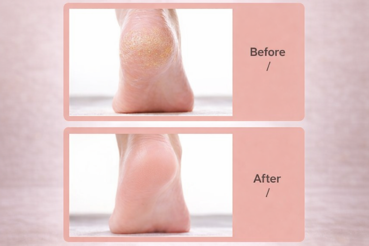 PUREVIA PediSmooth Pro Electric Foot File Callus Remover – detail shot